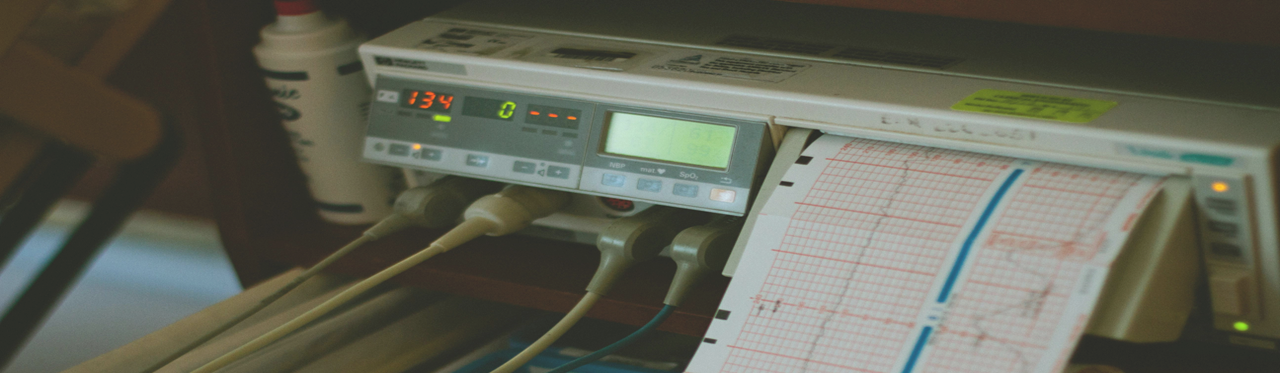 Modelling the impact of regionalising cardiac arrest centres, leading to work to standardise best practices