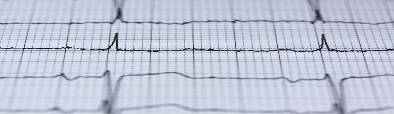 Using Machine Learning to identify factors that predict cardiac mortality